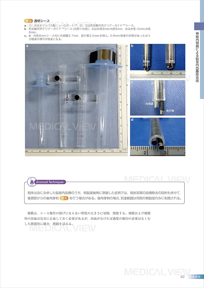 脳室を征服する (新NS NOW 13) : Amazon.sg: Books